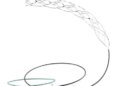 Amazing Make in India: Successful testing of 'Supernova' stent retriever under the leadership of AIIMS