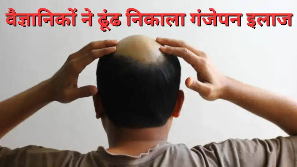 Baldness may now be a thing of the past! Scientists discovered! 'Miracle medicine' for hair growth, read full details of research here