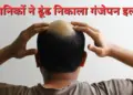 Baldness may now be a thing of the past! Scientists discovered! 'Miracle medicine' for hair growth, read full details of research here