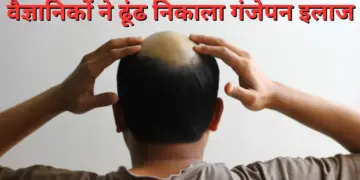 Baldness may now be a thing of the past! Scientists discovered! 'Miracle medicine' for hair growth, read full details of research here