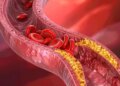 Cholesterol is essential for the body, only its excess is dangerous