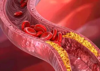 Cholesterol is essential for the body, only its excess is dangerous