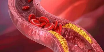 Cholesterol is essential for the body, only its excess is dangerous
