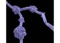 Drug-resistant fungus is extremely dangerous, spreading rapidly: report of Indian scientists