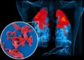 IIT Bombay study reveals how TB bacteria 'cheat' antibiotics