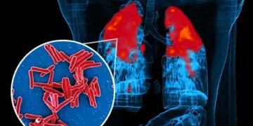 IIT Bombay study reveals how TB bacteria 'cheat' antibiotics
