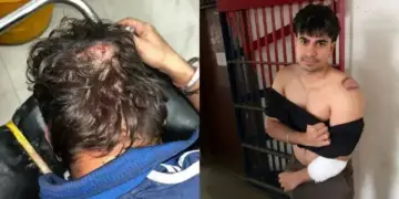 Jaipur: Chaos during birthday party in club of Malviya Nagar, bouncers attack on MBBS students, 10 injured