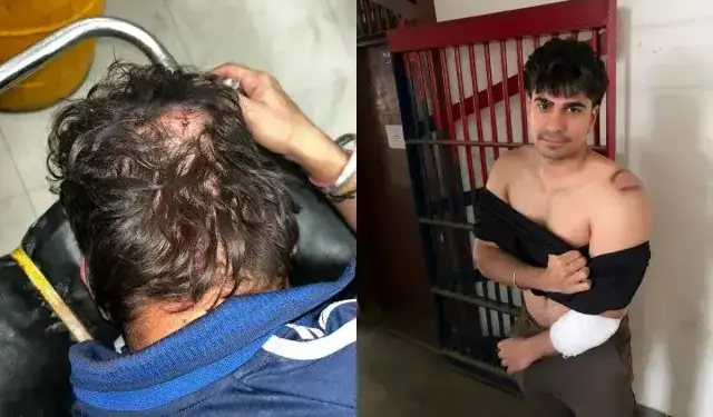 Jaipur: Chaos during birthday party in club of Malviya Nagar, bouncers attack on MBBS students, 10 injured