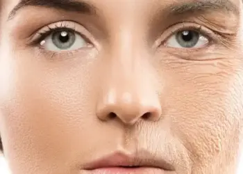'Loose skin and wrinkles on the face...' Due to deficiency of which vitamin the body ages quickly? Don't know how the shortage will be filled