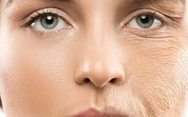 'Loose skin and wrinkles on the face...' Due to deficiency of which vitamin the body ages quickly? Don't know how the shortage will be filled