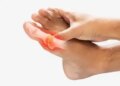 'Mango' is the main cause of arthritis, know the way to prevent it from Ayurveda