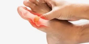 'Mango' is the main cause of arthritis, know the way to prevent it from Ayurveda