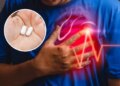 Silent attack on heart health! Russian doctor told about 5 such medicines which are fatal for your heart