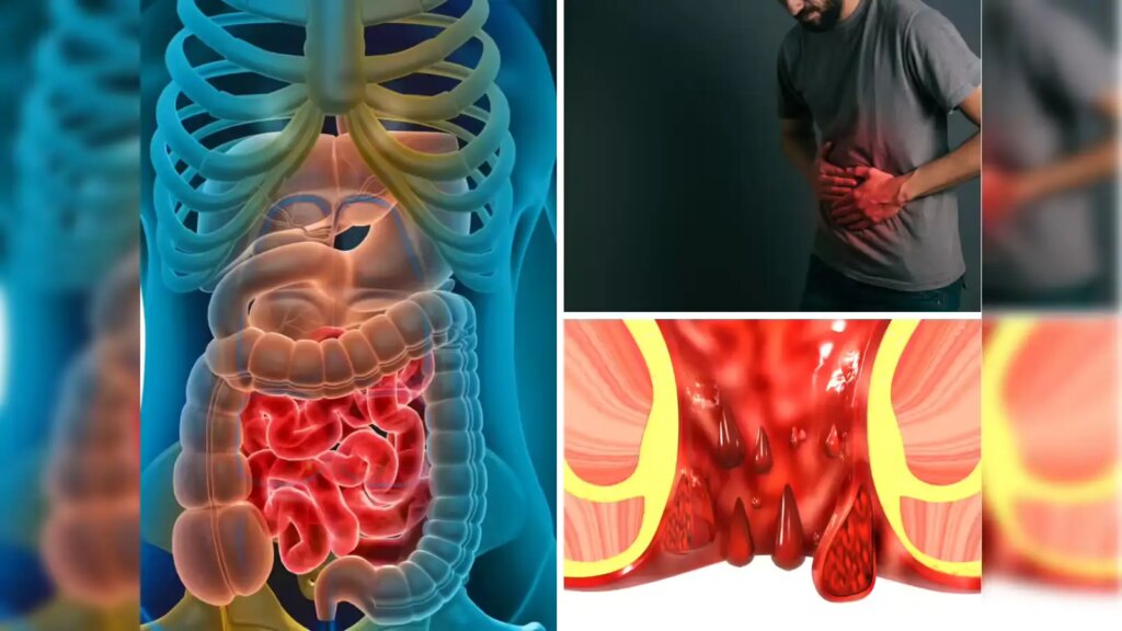 Warning to youth! If you see these 5 initial signs of Colon Cancer, consult a doctor immediately, ignoring it may prove costly.