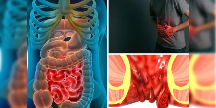 Warning to youth! If you see these 5 initial signs of Colon Cancer, consult a doctor immediately, ignoring it may prove costly.