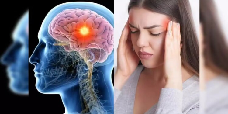 When does a minor headache become a brain tumor? Experts told its initial symptoms