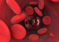 3 remedies of Ayurveda will remove the problem of anemia, some special things have to be kept in mind