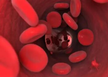 3 remedies of Ayurveda will remove the problem of anemia, some special things have to be kept in mind