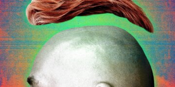 Baldness at 22 Why Gen Z appears to be losing hair faster than ever and what do the experts say?