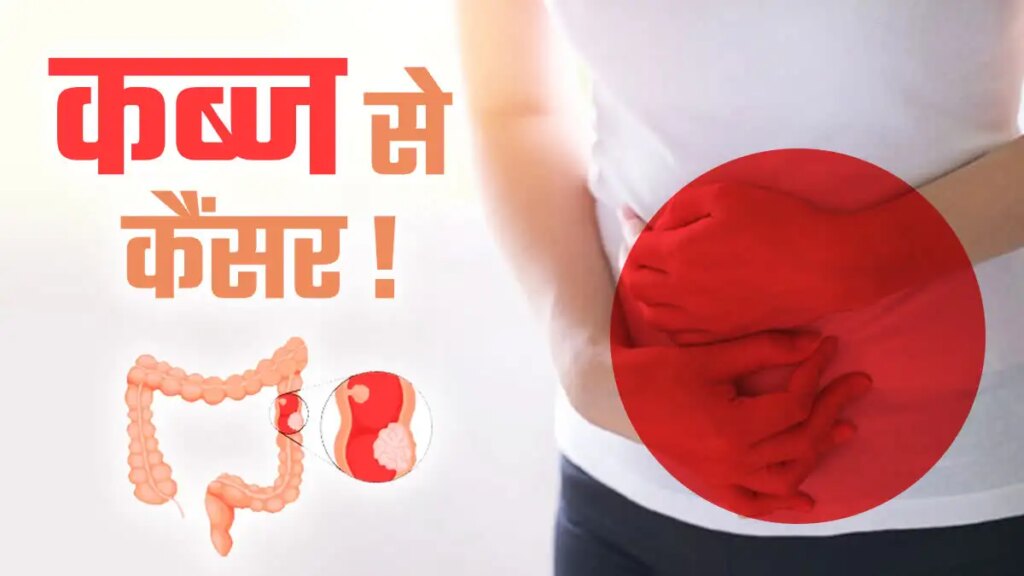 Do you know that the problem of constipation can also turn into a deadly cancer? Don't know when to be careful