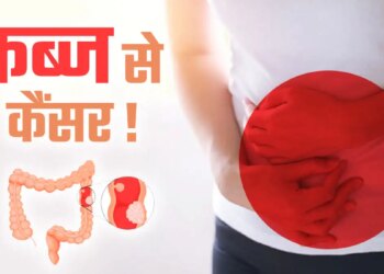 Do you know that the problem of constipation can also turn into a deadly cancer? Don't know when to be careful