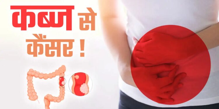 Do you know that the problem of constipation can also turn into a deadly cancer? Don't know when to be careful