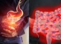 If you also drink less water then be careful! You can become a victim of this disease, know the symptoms