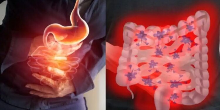 If you also drink less water then be careful! You can become a victim of this disease, know the symptoms