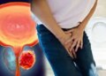 Men Health Alert: Do not ignore the problem of frequent urination, the risk of this dangerous cancer may increase.