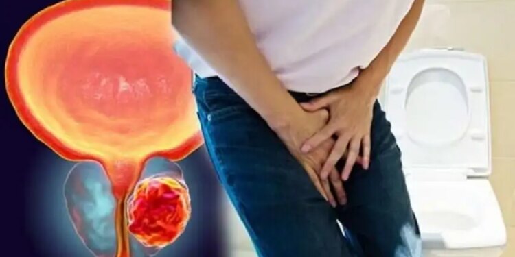 Men Health Alert: Do not ignore the problem of frequent urination, the risk of this dangerous cancer may increase.