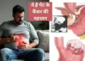 These 5 symptoms are seen in the beginning of stomach cancer, if ignored it can be life threatening.