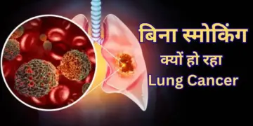 Why are children becoming victims of Lung Cancer even though they do not smoke? Know the big reasons behind this