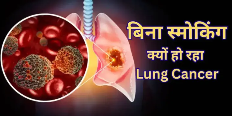 Why are children becoming victims of Lung Cancer even though they do not smoke? Know the big reasons behind this