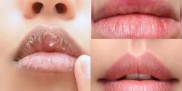 Why are lips the most dry in winter? Know the reasons and lip care tips from experts
