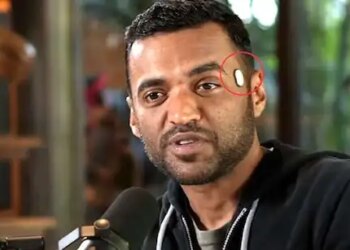Zomato CEO Deepinder Goyal's new gear goes viral! What is this unique device installed on his temple? what else works