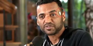 Zomato CEO Deepinder Goyal's new gear goes viral! What is this unique device installed on his temple? what else works