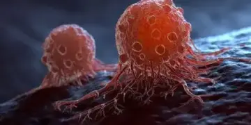 Cancer remains silent in the beginning! Why people are not able to recognize its early signs in time?