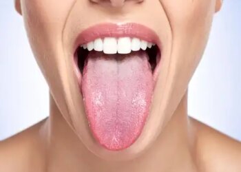 Do not take the problem of white tongue lightly, it indicates internal diseases of the body.