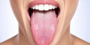 Do not take the problem of white tongue lightly, it indicates internal diseases of the body.