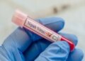 News of first death due to Nipah virus in West Bengal