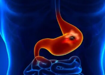 Stomach pain is not just a digestive problem, it is also a sign of internal stomach diseases, know the solution from Ayurveda.