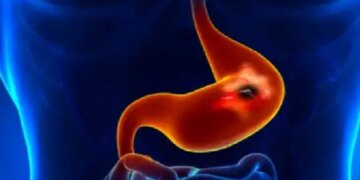 Stomach pain is not just a digestive problem, it is also a sign of internal stomach diseases, know the solution from Ayurveda.