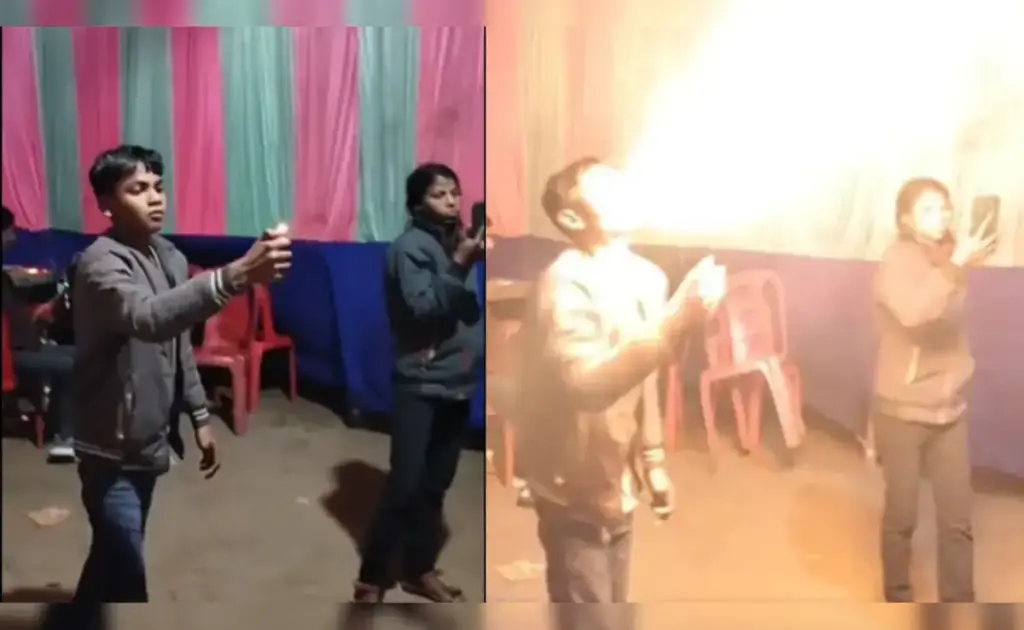 The charred face of the boy who fell into the trap of stunt and spewed fire from his mouth, watch the horrifying video.