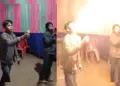 The charred face of the boy who fell into the trap of stunt and spewed fire from his mouth, watch the horrifying video.