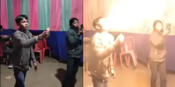 The charred face of the boy who fell into the trap of stunt and spewed fire from his mouth, watch the horrifying video.