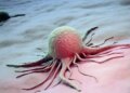 World Cancer Day 2026: How cancer starts, know those 7 symptoms which can be fatal if ignored