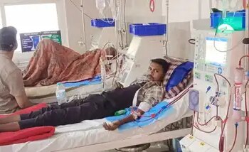 Ayushman Yojana becomes Sanjeevani for patients in Dewas, dialysis is being done for free