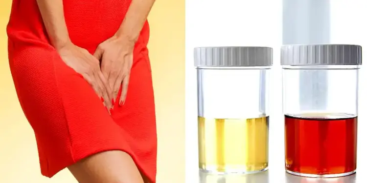 Dangerous reasons behind blood in urine, it is important to recognize it on time, otherwise your life may be in trouble.