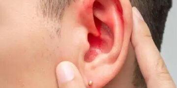 Do not ignore the fluid flowing from the ear, control the pain with these measures.