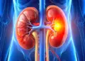 Early symptoms of kidney cancer: Do not ignore blood in urine, doctor told warning signs